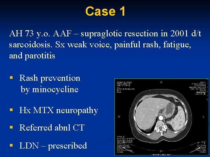 Case 1 AH 73 y. o. AAF – supraglotic resection in 2001 d/t sarcoidosis.