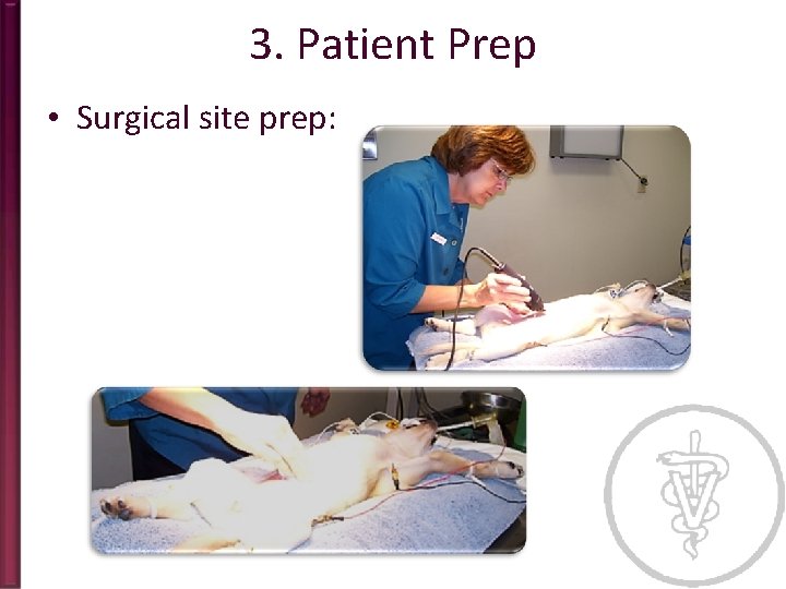 3. Patient Prep • Surgical site prep: 
