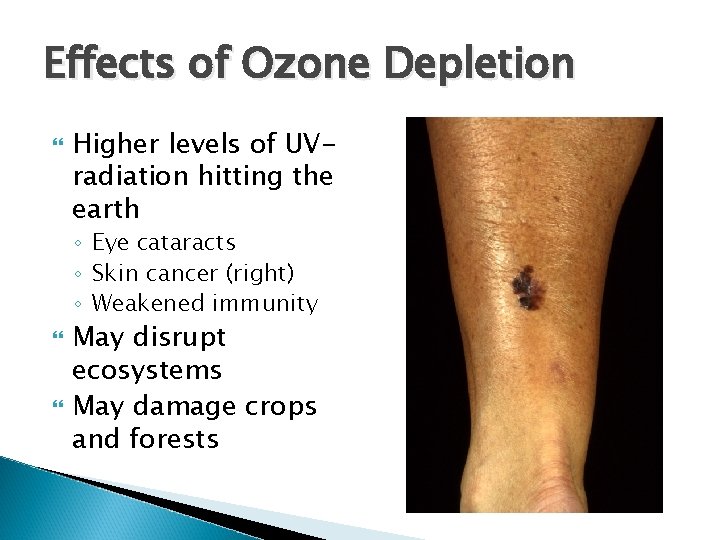 Effects of Ozone Depletion Higher levels of UVradiation hitting the earth ◦ Eye cataracts