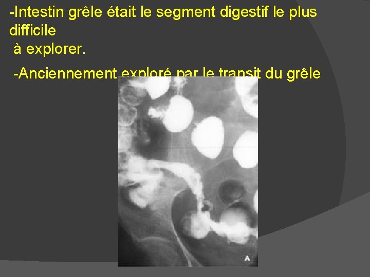 -Intestin grêle était le segment digestif le plus difficile à explorer. -Anciennement exploré par