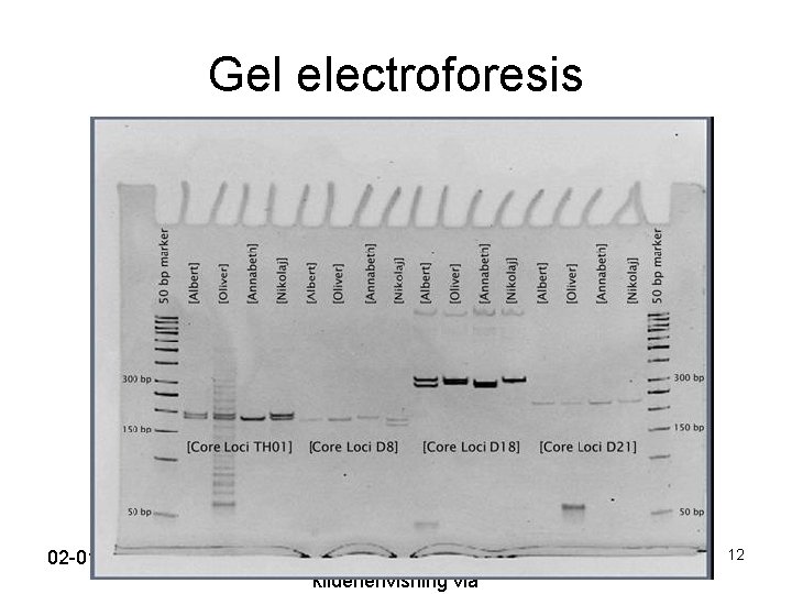 Gel electroforesis 02 -01 -2022 Indsæt note og kildehenvisning via 12 