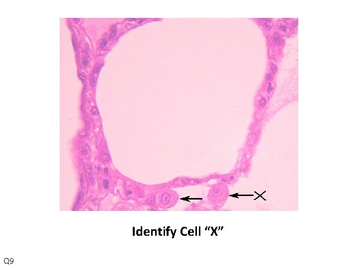 Identify Cell “X” Q 9 