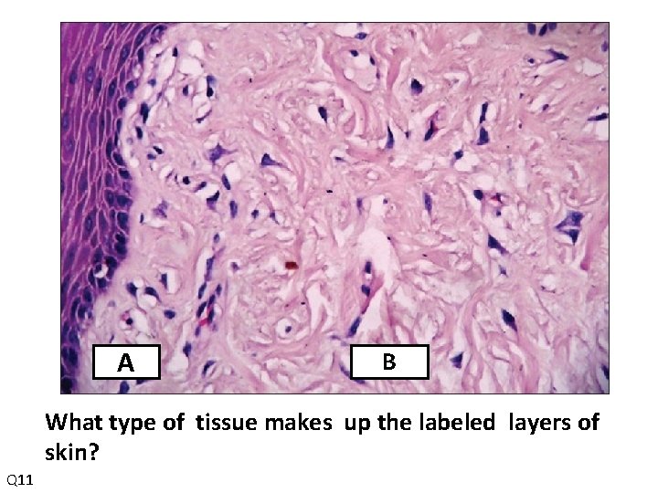 A B What type of tissue makes up the labeled layers of skin? Q