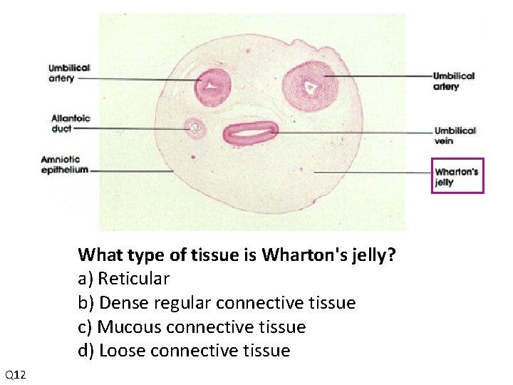 What type of tissue is Wharton's jelly? a) Reticular b) Dense regular connective tissue