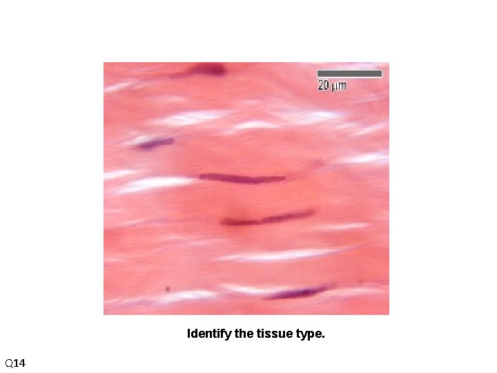 Identify the tissue type. Q 14 