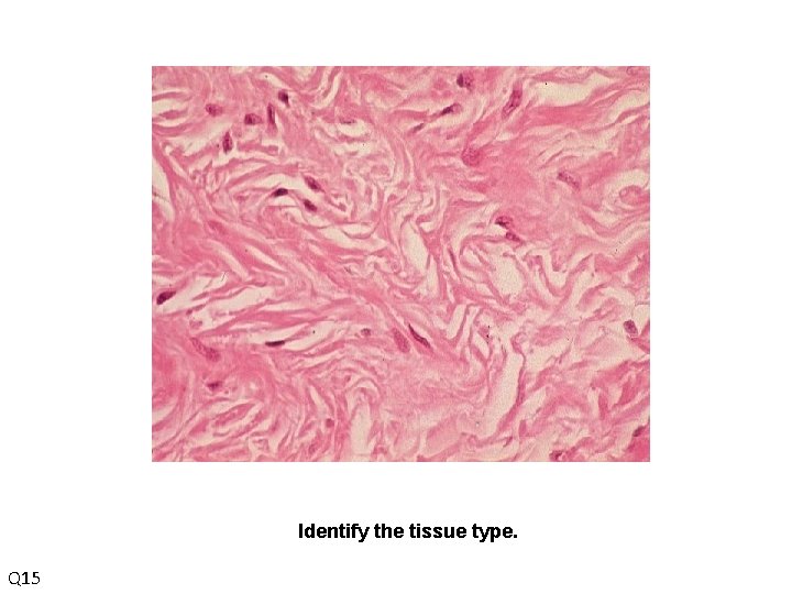 Identify the tissue type. Q 15 