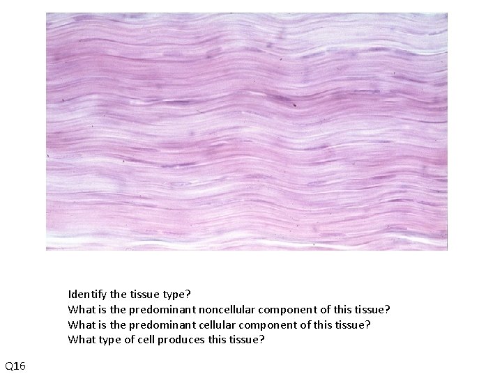 Identify the tissue type? What is the predominant noncellular component of this tissue? What