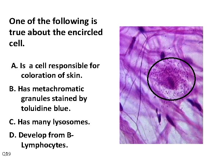 One of the following is true about the encircled cell. A. Is a cell