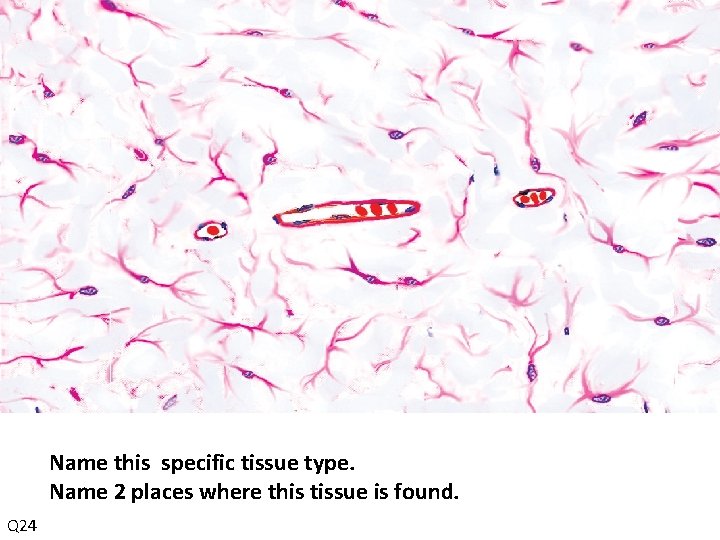 Name this specific tissue type. Name 2 places where this tissue is found. Q