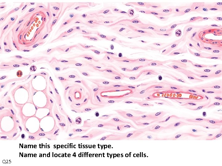 Q 25 Name this specific tissue type. Name and locate 4 different types of