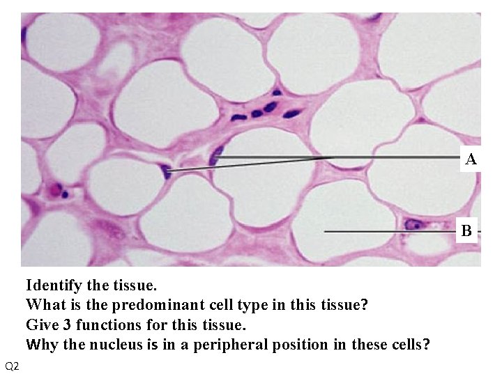 A B Identify the tissue. What is the predominant cell type in this tissue?
