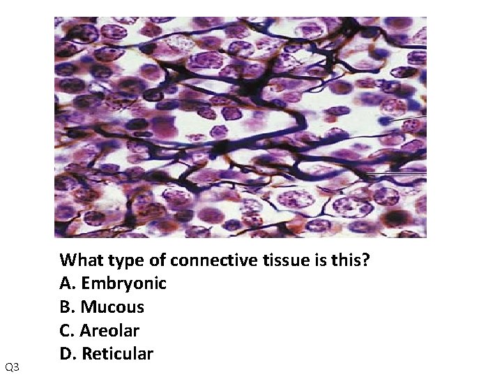 Q 3 What type of connective tissue is this? A. Embryonic B. Mucous C.