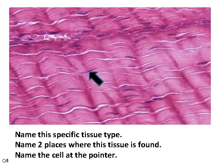 Q 4 Name this specific tissue type. Name 2 places where this tissue is
