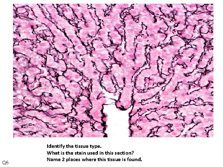 Q 6 Identify the tissue type. What is the stain used in this section?