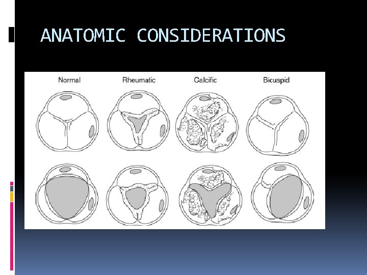 ANATOMIC CONSIDERATIONS 