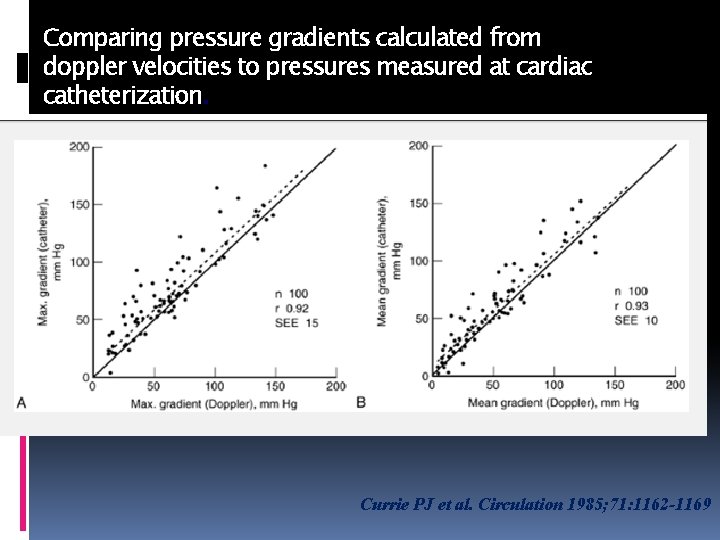 Comparing pressure gradients calculated from doppler velocities to pressures measured at cardiac catheterization. Currie