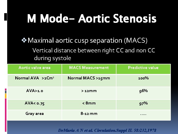 M Mode- Aortic Stenosis v Maximal aortic cusp separation (MACS) Vertical distance between right