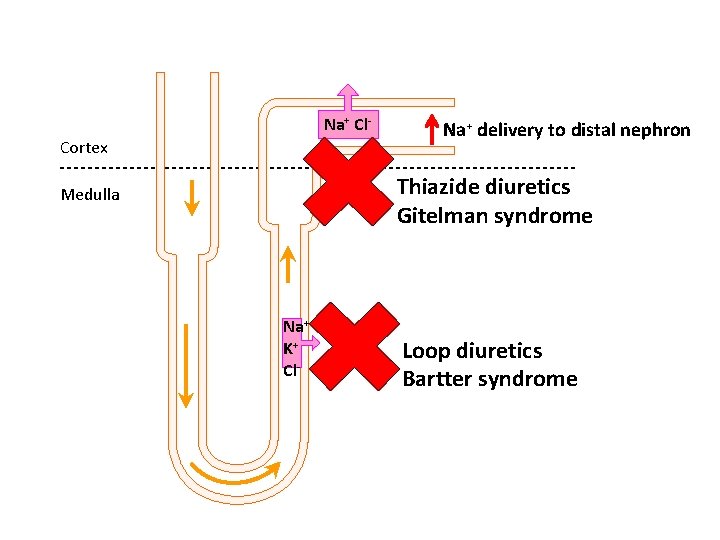 Na+ Cl. Cortex Na+ delivery to distal nephron Thiazide diuretics Gitelman syndrome Medulla Na+