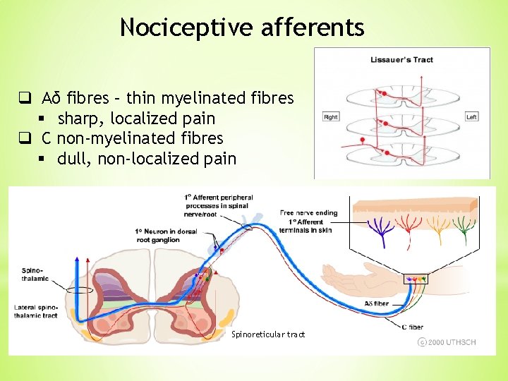 Nociceptive afferents q Aδ fibres – thin myelinated fibres § sharp, localized pain q Nociceptive afferents q Aδ fibres – thin myelinated fibres § sharp, localized pain q