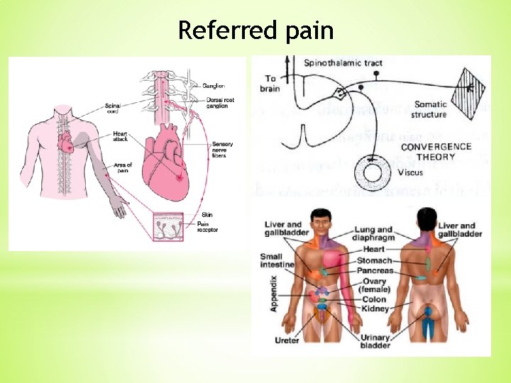 Referred pain Referred pain