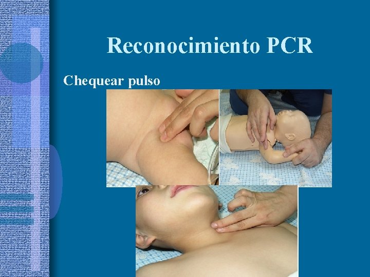 Reconocimiento PCR Chequear pulso 