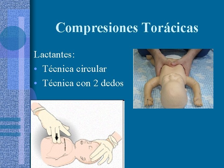 Compresiones Torácicas Lactantes: • Técnica circular • Técnica con 2 dedos 