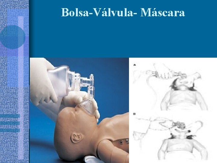 Bolsa-Válvula- Máscara 