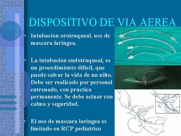 DISPOSITIVO DE VIA AEREA • Intubación orotraqueal, uso de mascara laringea. • La intubación