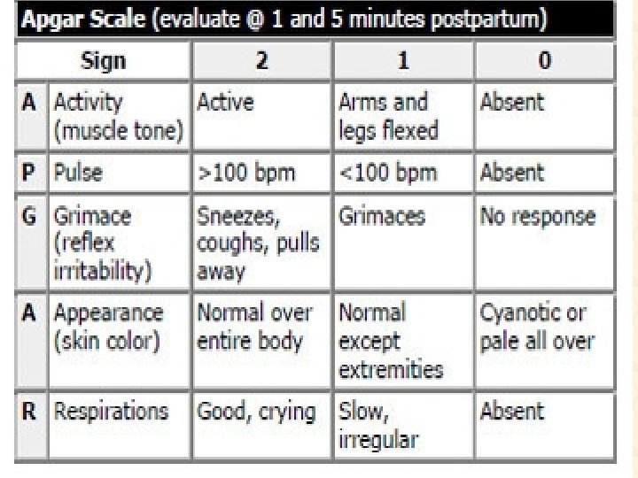 Newborn Examination Apgar score The Apgar score is