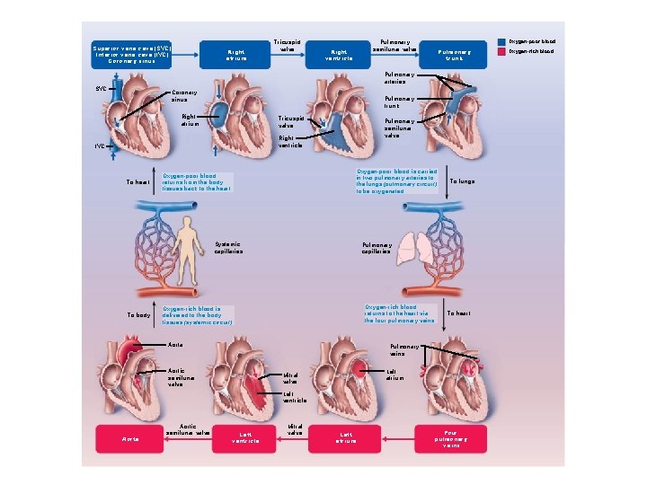 Superior vena cava (SVC) Inferior vena cava (IVC) Coronary sinus Right atrium Tricuspid valve