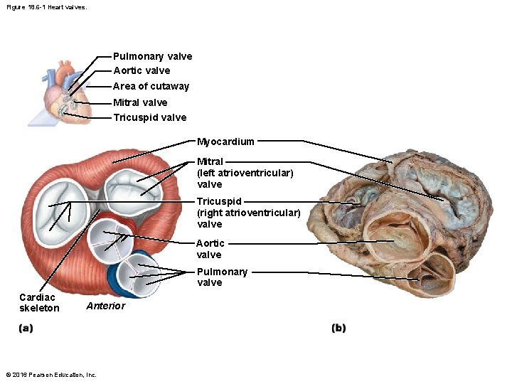 Figure 18. 6 -1 Heart valves. Pulmonary valve Aortic valve Area of cutaway Mitral