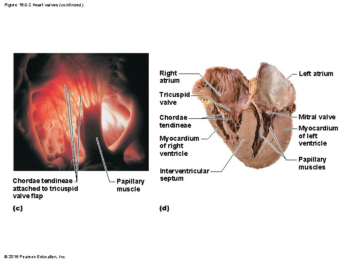 Figure 18. 6 -2 Heart valves (continued). Right atrium Left atrium Tricuspid valve Chordae