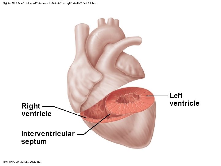 Figure 18. 9 Anatomical differences between the right and left ventricles. Right ventricle Interventricular