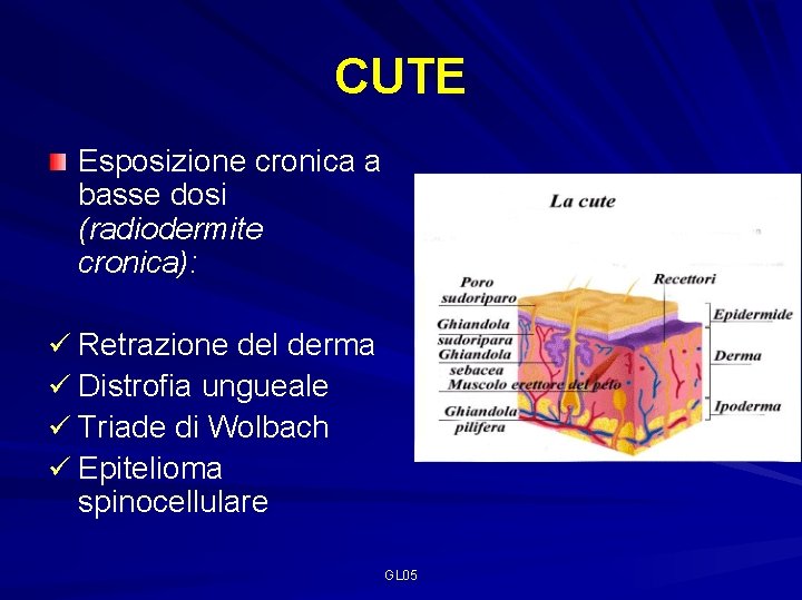 CUTE Esposizione cronica a basse dosi (radiodermite cronica): ü Retrazione del derma ü Distrofia