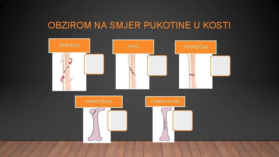 OBZIROM NA SMJER PUKOTINE U KOSTI SPIRALNI KOSI IMPAKTIRANI POPREČAN KOMINUTIVAN 