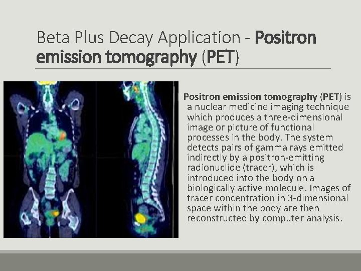 Beta Plus Decay Application - Positron emission tomography (PET) is a nuclear medicine imaging