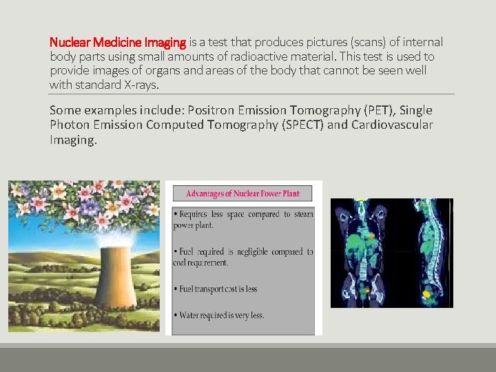 Nuclear Medicine Imaging is a test that produces pictures (scans) of internal body parts
