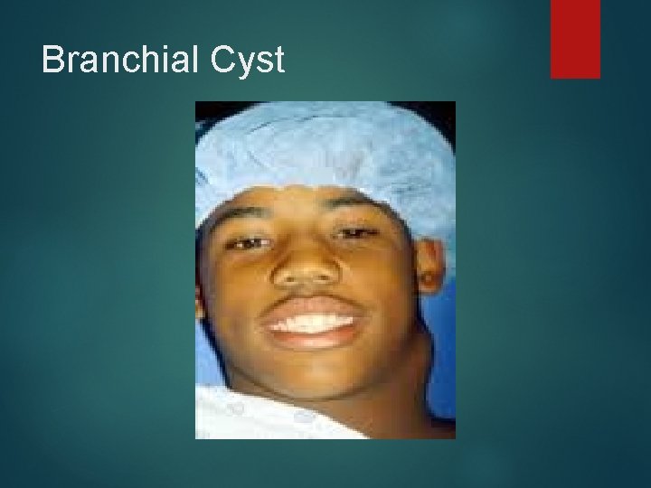 Branchial Cyst 