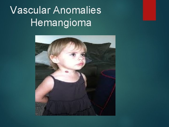 Vascular Anomalies Hemangioma 