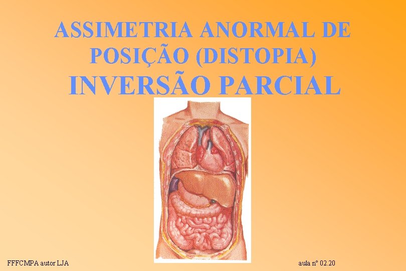 ASSIMETRIA ANORMAL DE POSIÇÃO (DISTOPIA) INVERSÃO PARCIAL FFFCMPA autor LJA aula nº 02. 20 ASSIMETRIA ANORMAL DE POSIÇÃO (DISTOPIA) INVERSÃO PARCIAL FFFCMPA autor LJA aula nº 02. 20