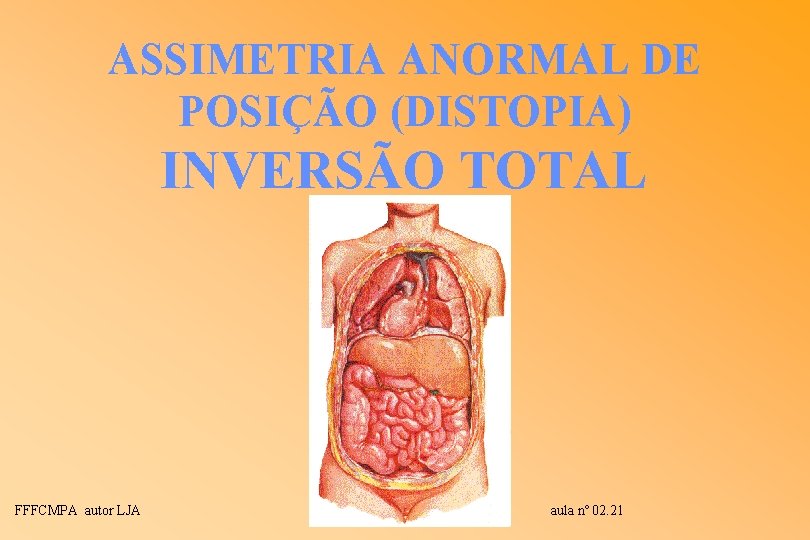 ASSIMETRIA ANORMAL DE POSIÇÃO (DISTOPIA) INVERSÃO TOTAL FFFCMPA autor LJA aula nº 02. 21 ASSIMETRIA ANORMAL DE POSIÇÃO (DISTOPIA) INVERSÃO TOTAL FFFCMPA autor LJA aula nº 02. 21