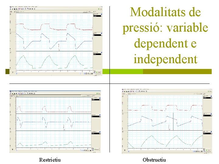 Modalitats de pressió: variable dependent e independent Restrictiu Obstructiu 