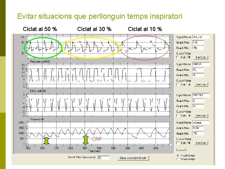 Evitar situacions que perllonguin temps inspiratori Ciclat al 50 % Ciclat al 30 %