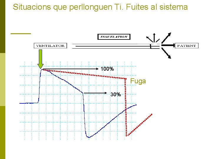 Situacions que perllonguen Ti. Fuites al sistema 100% Fuga 30% 