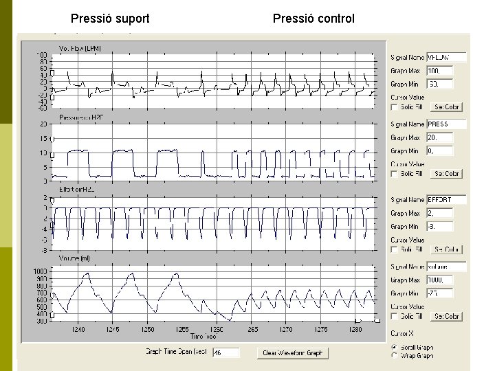 Pressió suport Pressió control 