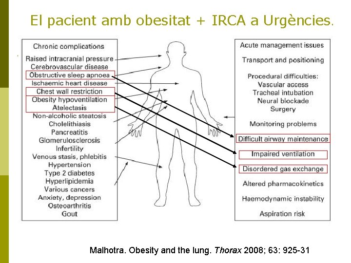 El pacient amb obesitat + IRCA a Urgències. Malhotra. Obesity and the lung. Thorax