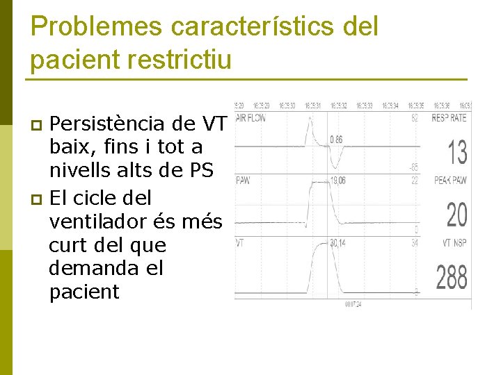 Problemes característics del pacient restrictiu Persistència de VT baix, fins i tot a nivells