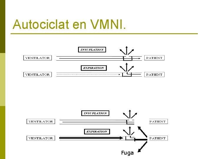 Autociclat en VMNI. Fuga 