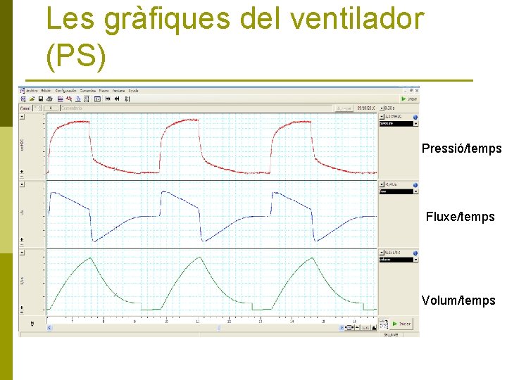 Les gràfiques del ventilador (PS) Pressió/temps Fluxe/temps Volum/temps 