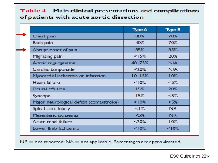 ESC Guidelines 2014 